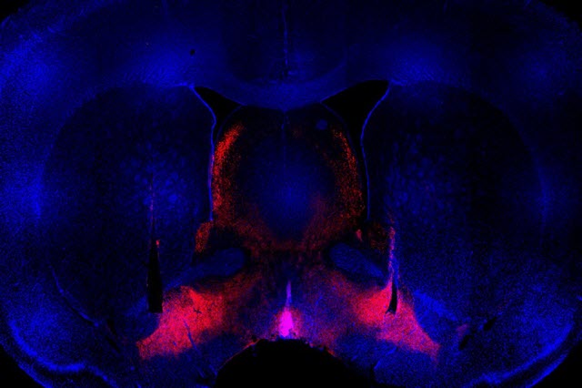 A view of a rat’s brain; the ventral pallidum