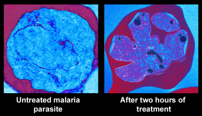 malaria parasite