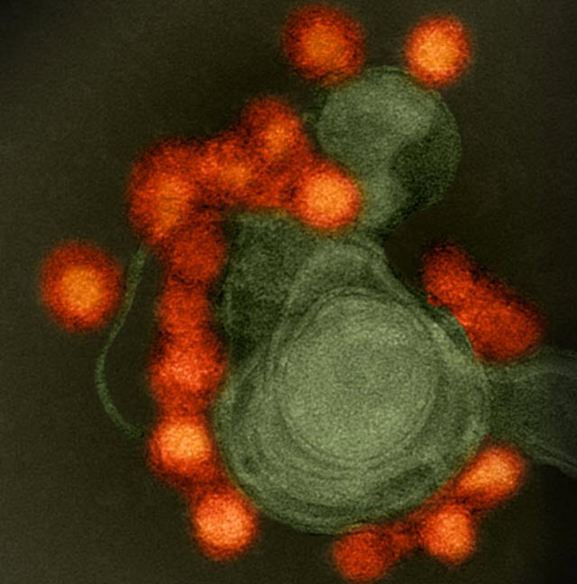 Zika Virus Protein