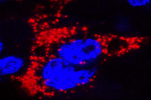 Two mouse models of Zika virus infection in pregnancy