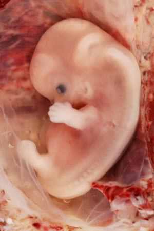 9-week-old human embryo