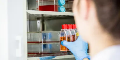 Navigate CO2 Incubator Selection with Confidence