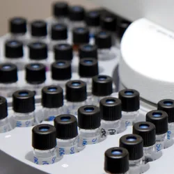 Beyond Helium: Carrier Gas Alternatives for Gas Chromatography