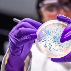 A scientist pipettes into a petri dish with small blue cell colonies in it