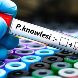 A gloved hand holds a test tube labeled "P. knowlesi" with a positive test result, against a background of colorful sample vials.