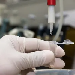 a gloved hand holds a plastic tube with liquid for protein purification which can be performed by affinity purification or ion exhgange purification methods