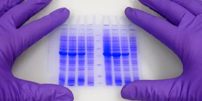 purple gloved hands holding a dyed gel plate scientists must choose between capillary and gel electrophoresis for separations