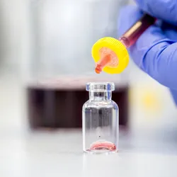 lab technician filters a sample into a vial when preparing samples technicians may have to choose from SPE, LLE, or filtration methods