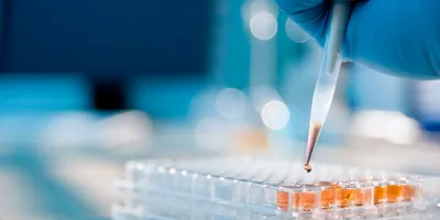 Hand inserting liquid into a plate by hand, using a pipette.