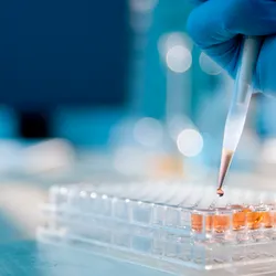 Hand inserting liquid into a plate by hand, using a pipette.