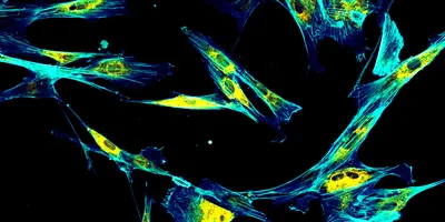 Immunofluorescence confocal imaging of fibroblasts with endoplasmic reticulum in yellow and cytoskeleton in cyan