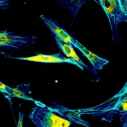 Immunofluorescence confocal imaging of fibroblasts with endoplasmic reticulum in yellow and cytoskeleton in cyan