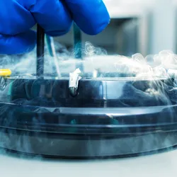 Gloved hand retrieving vials from liquid nitrogen cryogenic storage for cell preservation.