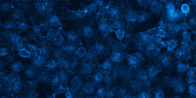 Bioluminescence image of Genome edited HeLa cells expressing HiBiT-EGFR, which is localized to the cell membrane and is complemented with purified LgBiT. Upon treatment with substrate, image was taken with the GloMaxTM Galaxy bioluminescent imager with a 120-second exposure time.