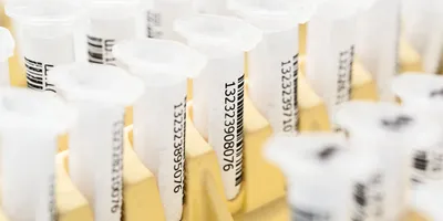 Sample Storage Content List | Lab Manager