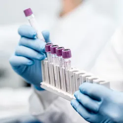 Laboratory assistant putting test tubes into into a test tube rack, close-up view focused on the tubes