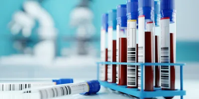 Laboratory test tubes related to NGS-based cancer diagnostics