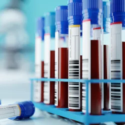 Laboratory test tubes related to NGS-based cancer diagnostics