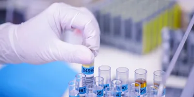 Scientist handling biological materials in a laboratory.