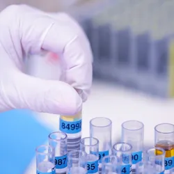 Scientist handling biological materials in a laboratory.