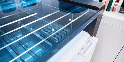 A clinical immunoassay analyzer with racks of patient sample tubes staged under an automated loading bay in a core laboratory.