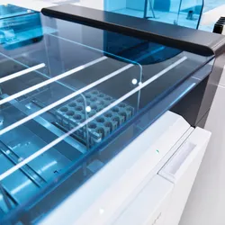 A clinical immunoassay analyzer with racks of patient sample tubes staged under an automated loading bay in a core laboratory.