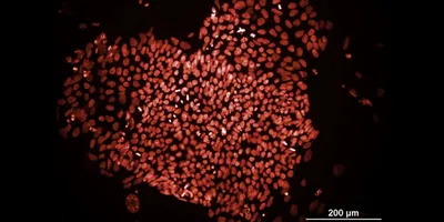 Microscope image of stem cell-derived cardiomyocytes for AI drug safety testing