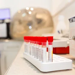 Laboratory biochemical analysis test tubes