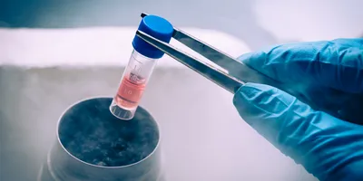 Laboratory scene showing cryogenic storage techniques