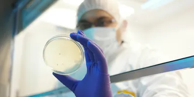 Environmental monitoring in pharma using a settle plate