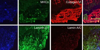 Staining results from an Amsbio differentiation kit.