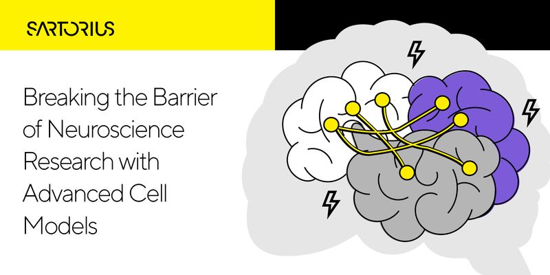 Simon Brain Model The Architecture of Your Brain Model Determines Your Data | Lab Manager