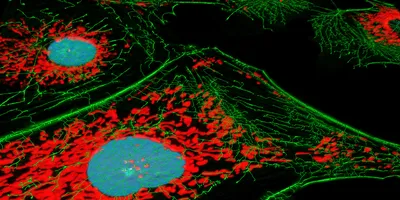 Fibroblast cells, fluorescence microscopy, nuclei, mitichondria, and microfilaments