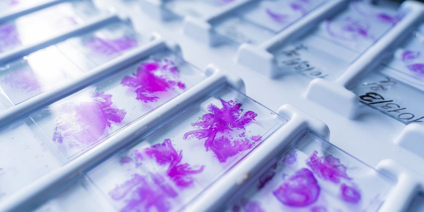 Close-up of slides related to single-cell sequencing studies