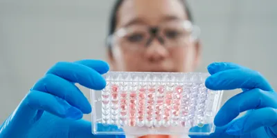 Close-up of a researcher holding a testing plate for chemical assessments.