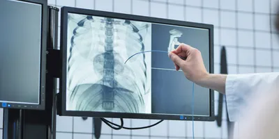 Radiation safety practice in fluoroscopy lab