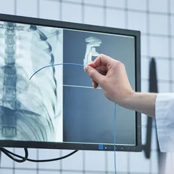 Radiation safety practice in fluoroscopy lab