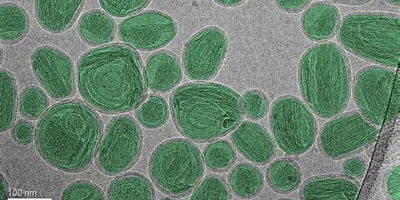 Nanoparticles highlighted in microscopy for size measurement studies