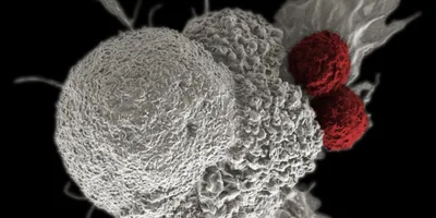 Close-up of patient-derived cancer models under a microscope