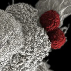 Close-up of patient-derived cancer models under a microscope
