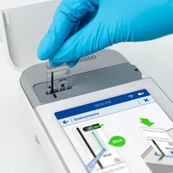 Mettler Toledo's CytoDirect, an automated stain-free cell counter 