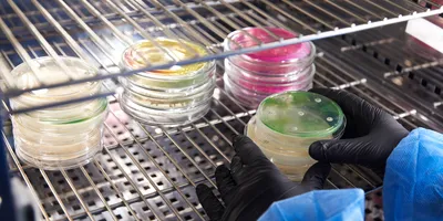 Gloved Hand of a Technician or scientist working holding petri dishes in the microbiology laboratory.