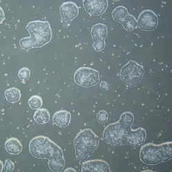 Phase-contrast micrograph of human iPSC colonies grown using StemFit Basic04CT feeder-free culture medium, showing healthy colony morphology.