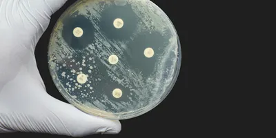 Beyond the AST Result: What Lab Leaders Need to Get Right | Lab Manager
