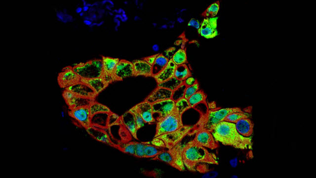 organoids for pancreas cancer research