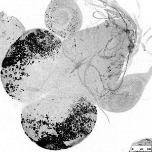 Microscope image of female larval brain of a hybrid of two fruit fly species