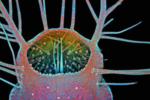 Third Place 2015 PHOTOMICROGRAPHY COMPETITION