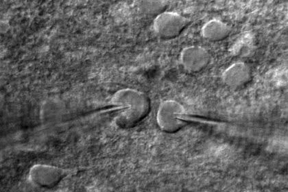 Isolated cells in the visual cortex of a mouse