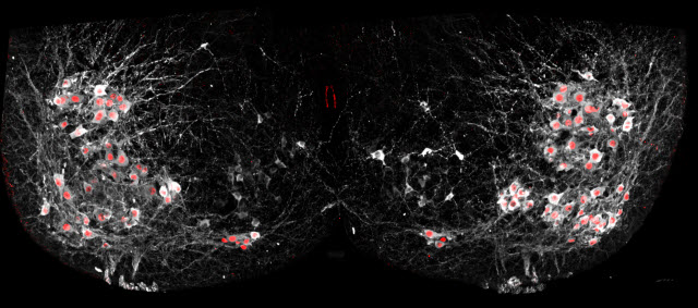 Salk scientists were able to selectively add fluorescent proteins to the nuclei of motor neurons