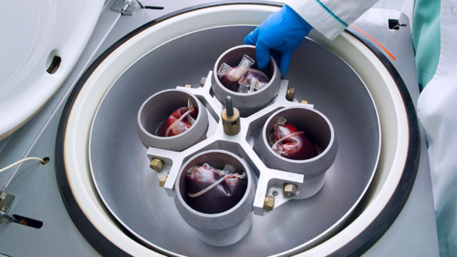blood bank centrifuge
